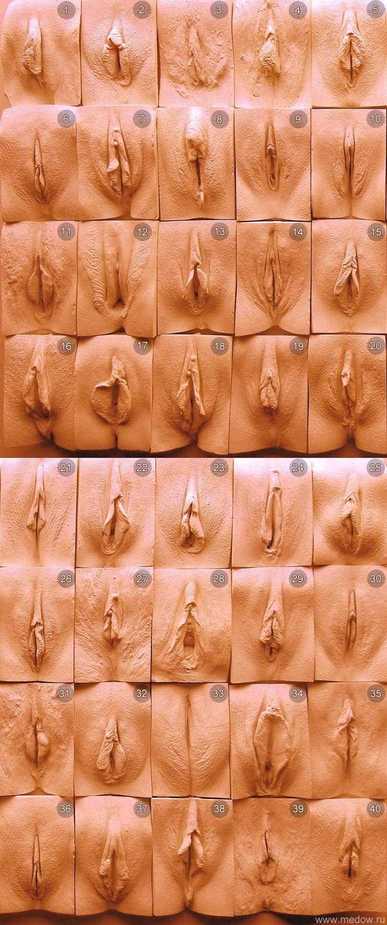 Formes de parties génitales féminines
