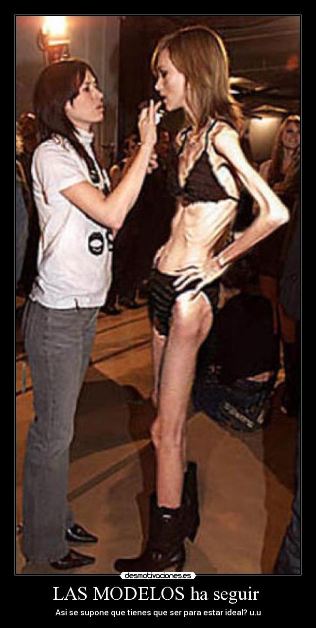 Physique dystrophique