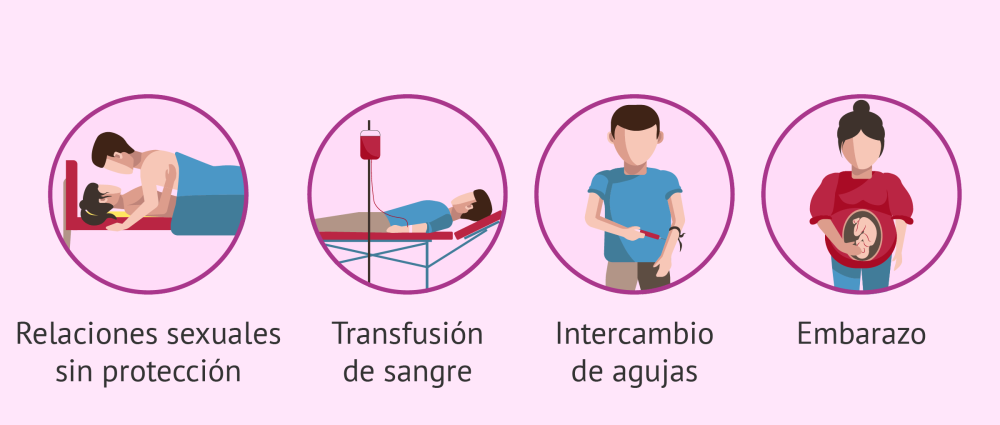 Le dysfonctionnement sexuel avec l'infection par le VIH est un quizlet