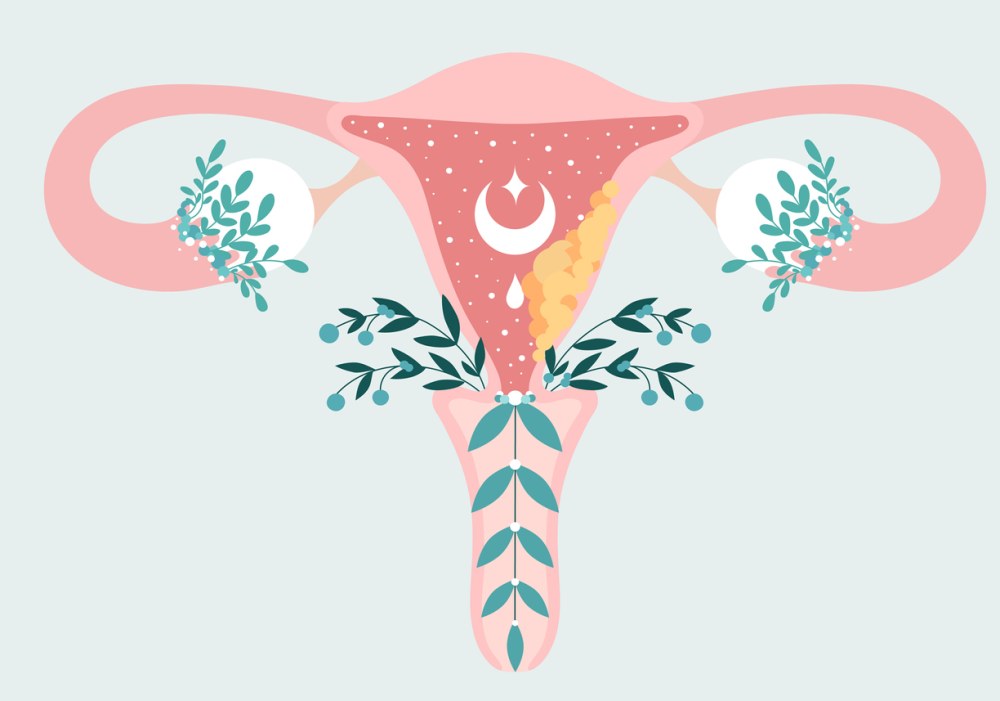 • BRCA2: cancer du sein 2, début précoce