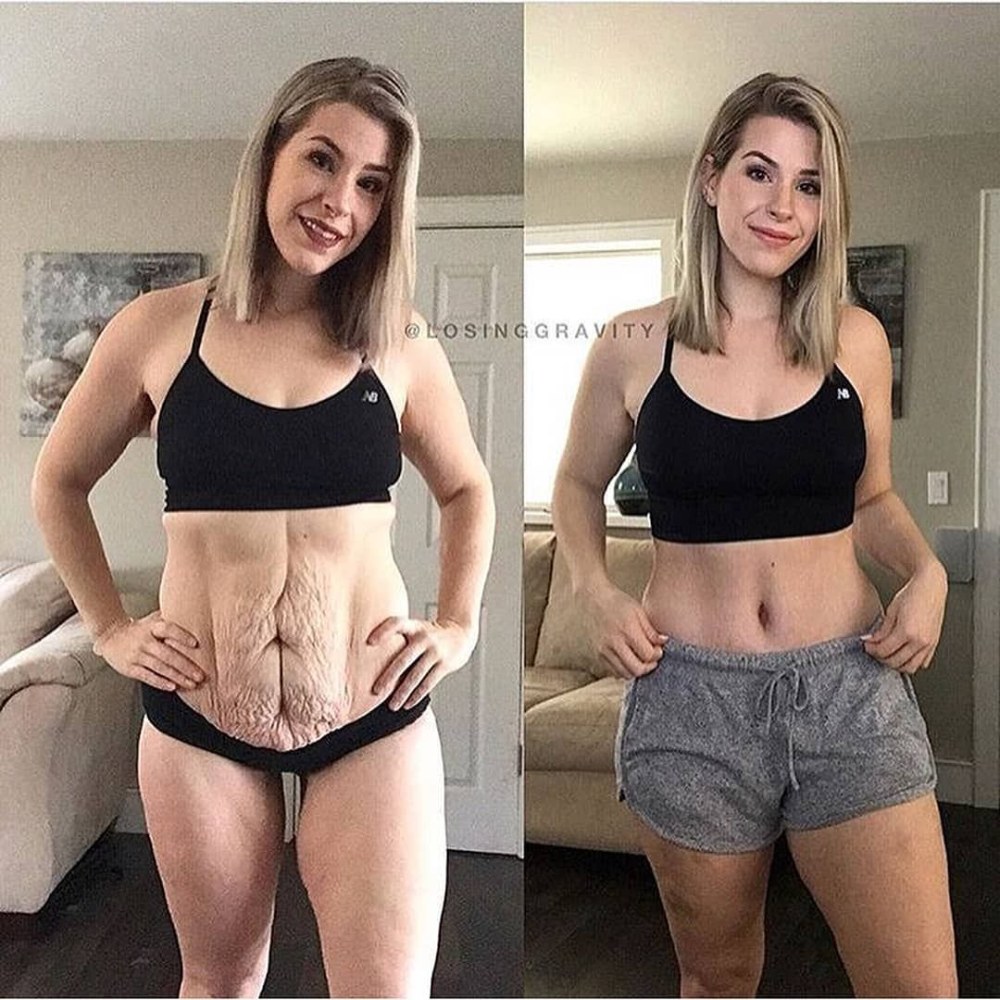La grossesse est drôle
