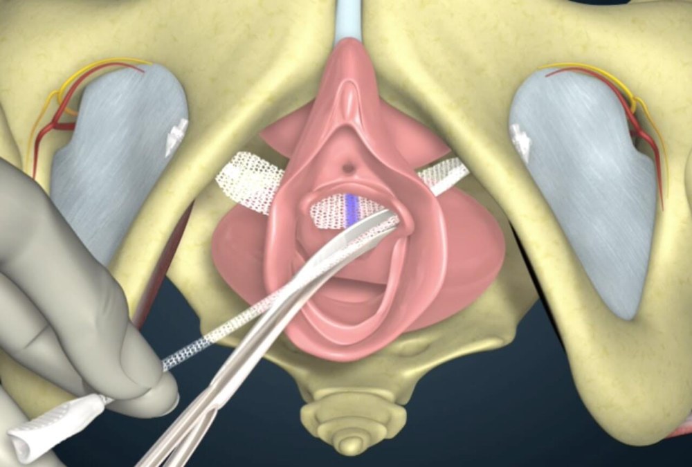 Camérons
