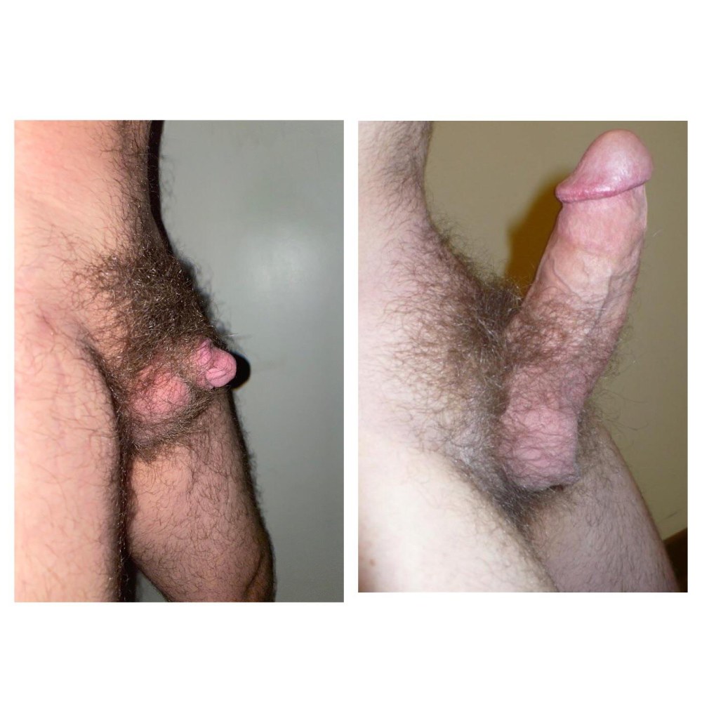 Les hommes tirent le scrotum