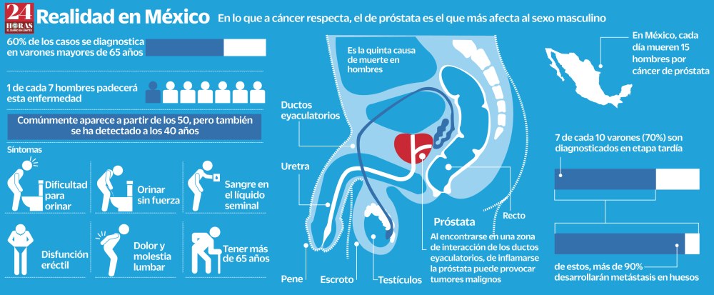Auto-examen un GL Mamare