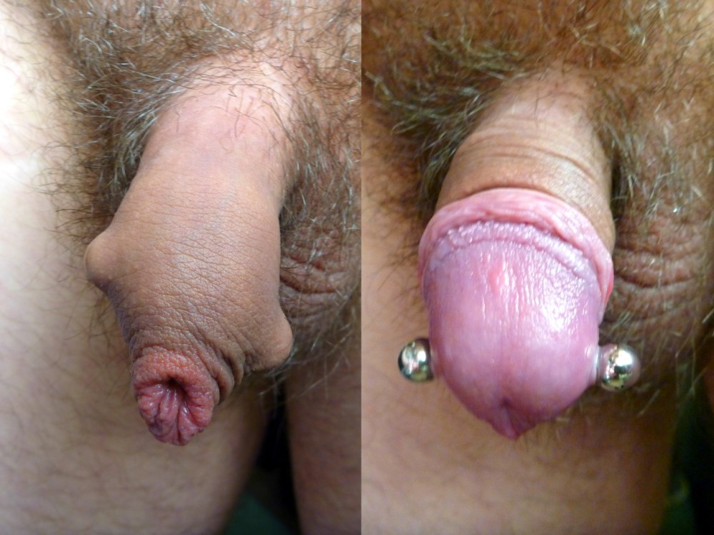 Anneaux d'érection pour Dick